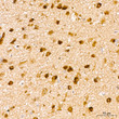 Immunohistochemistry analysis of paraffin-embedded Rat brain tissue using Phospho-NF2-S518 Rabbit pAb (STJ11107692) at a dilution of 1:200 (40x lens). High pressure antigen retrieval performed with 0. 01M Citrate Bufferr (pH 6. 0) prior to immunohistochemistry staining.