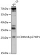 Western blot analysis of lysates from PC-12 cells, using CDKN1B/p27KIP1 Rabbit pAb (STJ115573) at 1:1000 dilution. <br/>Secondary antibody: HRP-conjugated Goat anti-Rabbit IgG (H+L) (STJS000856) at 1:10000 dilution. <br/>Lysates/proteins: 25 Mu g per lane. <br/>Blocking buffer: 3% nonfat dry milk in TBST. <br/>Detection: ECL Enhanced Kit <br/>Exposure time: 90s.