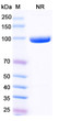 Anti-VSV NP/Nucleoprotein-san Juan antibody [1001] (STJA0018662)
