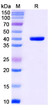 Anti-Aflatoxin B1 antibody [Nb26] (STJA0019639)