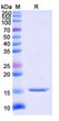 Anti-AKT1 nanobody [SAA1231] (STJN000197)