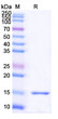 Anti-PTCH1 nanobody [SAA1343] (STJN000266)