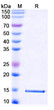 Anti-Zaire ebolavirus/ZEBOV GP/GP1, 2-strain Mayinga-76 nanobody [SAA1248] (STJN000433)
