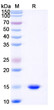 Anti-Castor bean Ricin nanobody [SAA0991] (STJN000507)
