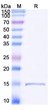 Anti-Castor bean Ricin nanobody [SAA1119] (STJN000515)