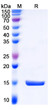 Anti-Castor bean Ricin nanobody [SAA1149] (STJN000522)