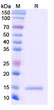 Anti-EGFR/ERBB1/HER1 nanobody [7D12] (STJN000584)
