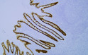 Immunohistochemistry - Paraffin (IHC-P): Human appendix tissue was stained with Anti-CDX2 (PT0064) Antibody STJA0038884