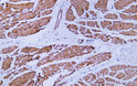 Immunohistochemistry - Paraffin (IHC-P): Human smooth muscle tissue was stained with anti-caldesmon (ABT125) antibody. STJA0038908