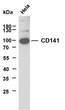 Western Blot (WB): HeLa whole cell lysates were separated by 10% SDS-PAGE, and the membrane was blotted with anti-CD141 STJA0038914