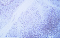 Immunohistochemistry - Paraffin (IHC-P): Human tonsil tissue was stained with anti-CD2 (ABT529) antibody. STJA0038920