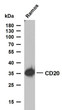 Western Blot (WB): Ramos whole cell lysates were separated by 10% SDS-PAGE, and the membrane was blotted with anti-CD20 STJA0038921