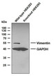 Western Blot (WB): Various whole cell lysates were separated by 10% SDS-PAGE, and the membrane was blotted with STJA0038923