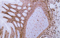 Immunohistochemistry - Paraffin (IHC-P): Human appendix tissue was stained with Anti-Vimentin (ABT019) antibody. STJA0038923