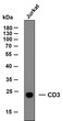 Western Blot (WB): Whole cell lysates of Jurkat were separated by 12% SDS-PAGE, and the membrane was blotted with STJA0038925