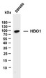Western Blot (WB): Whole cell lysates were separated by 4%-20% SDS-PAGE, and the membrane was blotted with anti-HBO1 STJA0038926