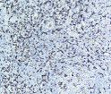 Immunohistochemistry - Paraffin (IHC-P): Human tonsil tissue was stained with Anti-Iba1 (PTR1347) Antibody STJA0038953