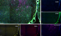 Immunofluorescence (IF): Fluorescence multiplex immunohistochemical analysis of mouse brain tissue (formalin-fixed STJA0038953