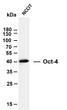 Western Blot (WB): Whole cell lysates were separated by 10% SDS-PAGE, and the membrane was blotted with anti-Oct-4 STJA0038957