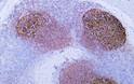 Immunohistochemistry - Paraffin (IHC-P): Human tonsil tissue was stained with Anti-CD35 (ABT-CD35) Antibody. STJA0038962