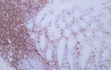 Immunohistochemistry - Paraffin (IHC-P): Human appendix tissue was stained with Anti-CD43 (ABT027) antibody. STJA0038964