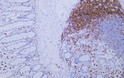 Immunohistochemistry - Paraffin (IHC-P): Human colon tissue was stained with Anti-CD5 (ABT-CD5) antibody. STJA0038967