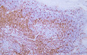 Immunohistochemistry - Paraffin (IHC-P): Human tonsil tissue was stained with anti-CD5 (ABT-CD5) antibody. STJA0038967