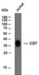 Western Blot (WB): Whole cell lysates of Jurkat were separated by 12% SDS-PAGE, and the membrane was blotted with STJA0038971