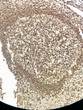 Immunohistochemistry - Paraffin (IHC-P): Human appendix tissue was stained with anti-CD74 (ABT202) antibody. STJA0038972