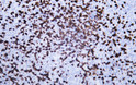 Immunohistochemistry (IHC): Human lymphoma tissue was stained with Anti-CD8 (ABT155) antibody. STJA0038974