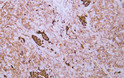 Immunohistochemistry - Paraffin (IHC-P): Human pancreas tissue was stained with Anti-CD99 (ABT156) antibody. STJA0038975