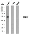 Western Blot (WB): Various whole cell lysates were separated by 10% SDS-PAGE, and the membrane was blotted with STJA0038976