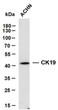 Western Blot (WB): ACHN whole cell lysates were separated by 10% SDS-PAGE, and the membrane was blotted with anti-CK19 STJA0038982