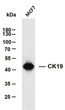 Western Blot (WB): MCF7 whole cell lysates were separated by 10% SDS-PAGE, and the membrane was blotted with anti-CK19 STJA0038982