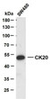 Western Blot (WB): SW480 whole cell lysates were separated by 10% SDS-PAGE, and the membrane was blotted with anti-CK20 STJA0038983