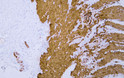 Immunohistochemistry - Paraffin (IHC-P): Human smooth muscle tissue was stained with Anti-Desmin (ABT168) antibody. STJA0038993