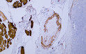 Immunohistochemistry - Paraffin (IHC-P): Human tonsil tissue was stained with Anti-Desmin (ABT168) Antibody. STJA0038993