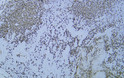 Immunohistochemistry - Paraffin (IHC-P): Tonsil tissue was stained with Anti-CD20 (PTR1337/065) antibody. STJA0038996