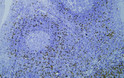 Immunohistochemistry - Paraffin (IHC-P): Human tonsil tissue was stained with anti-CD8a (PTR1338/155) antibody. STJA0038997