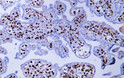 Immunohistochemistry - Paraffin (IHC-P): Human placenta tissue was stained with Anti-Factor XIIIa (ABT170) Antibody. STJA0038999