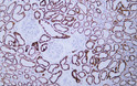 Immunohistochemistry - Paraffin (IHC-P): Human kidney tissue was stained with anti-HSP60 (ABT186) antibody. STJA0039008