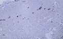 Immunohistochemistry - Paraffin (IHC-P): Human appendix tissue was stained with Anti-Neurofilament (ABT356) Antibody. STJA0039015