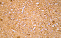 Immunohistochemistry - Paraffin (IHC-P): Human cerebrum tissue was stained with Anti-Neurofilament (ABT356) Antibody. STJA0039015