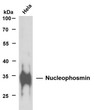 Western Blot (WB): HeLa whole cell lysates were separated by 10% SDS-PAGE, and the membrane was blotted with STJA0039017