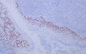 Immunohistochemistry - Paraffin (IHC-P): Human tonsil tissue was stained with Anti-p63 (ABT-P63) antibody. STJA0039021