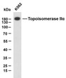 Western Blot (WB): K562 whole cell lysates were separated by 10% SDS-PAGE, and the membrane was blotted with STJA0039030