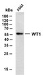 Western Blot (WB): K562 whole cell lysates were separated by 10% SDS-PAGE, and the membrane was blotted with anti-WT1 STJA0039032