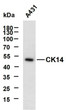 Western Blot (WB): A431 whole cell lysates were separated by 10% SDS-PAGE, and the membrane was blotted with anti-CK14 STJA0039051