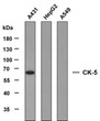 Western Blot (WB): Various whole cell lysates were separated by 8% SDS-PAGE, and the membrane was blotted with anti-CK5 STJA0039054