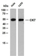 Western Blot (WB): Various whole cell lysates were separated by 12% SDS-PAGE, and the membrane was blotted with STJA0039055